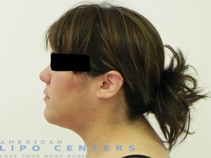 americanlipocenters_54.jpg